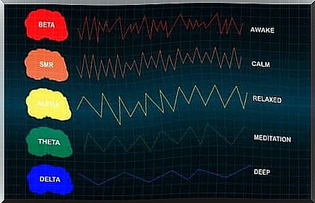 Changes in brain activity can be recorded on an electroencephalogram